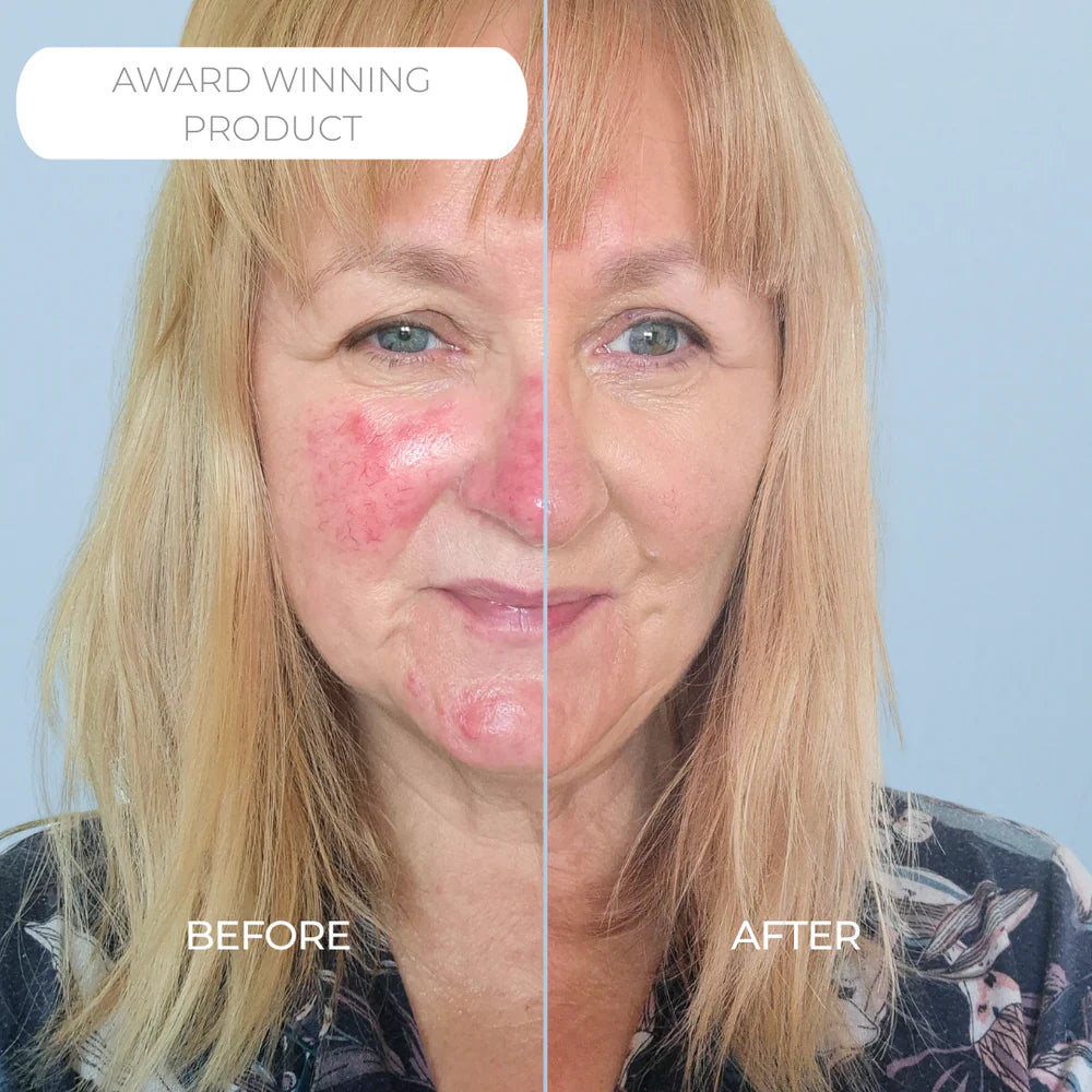 Rosalique 3in1 Anti Redness Miracle Formula