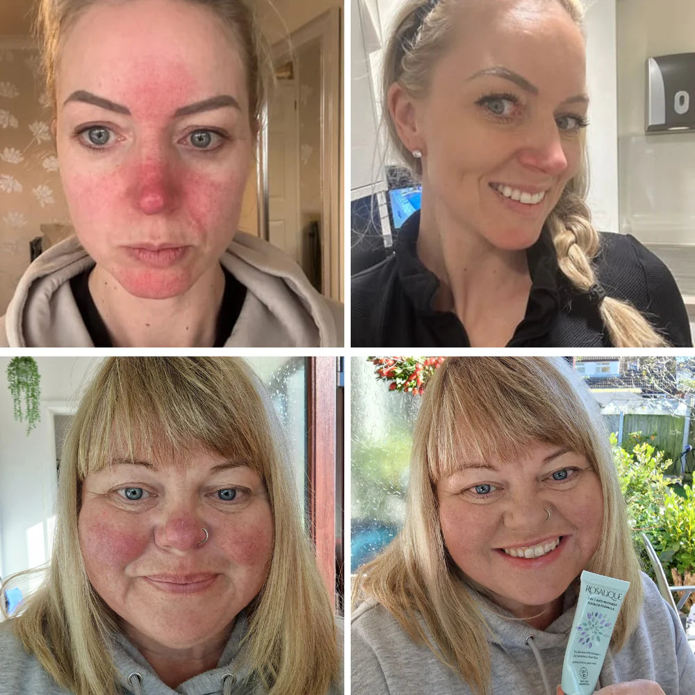 Rosalique 3in1 Anti Redness Miracle Formula