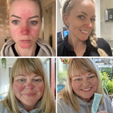 Rosalique 3in1 Anti Redness Miracle Formula