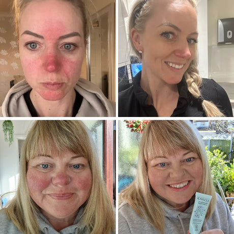Rosalique 3in1 Anti Redness Miracle Formula